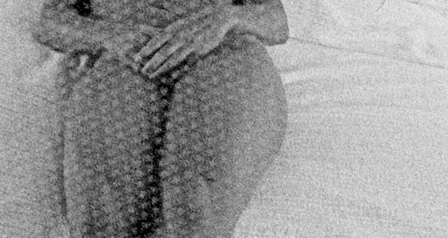 Janet 1985 St. Barts Misc261 Version 3